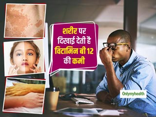 चेहरे पर आए ये 3 बड़े बदलाव हैं विटामिन बी 12 की कमी के संकेत, जानें कैसे पूरें इसकी कमी  